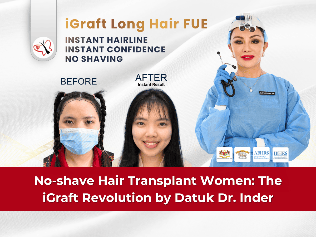 Illustration of the no-shave iGraft Long Hair FUE approach for women